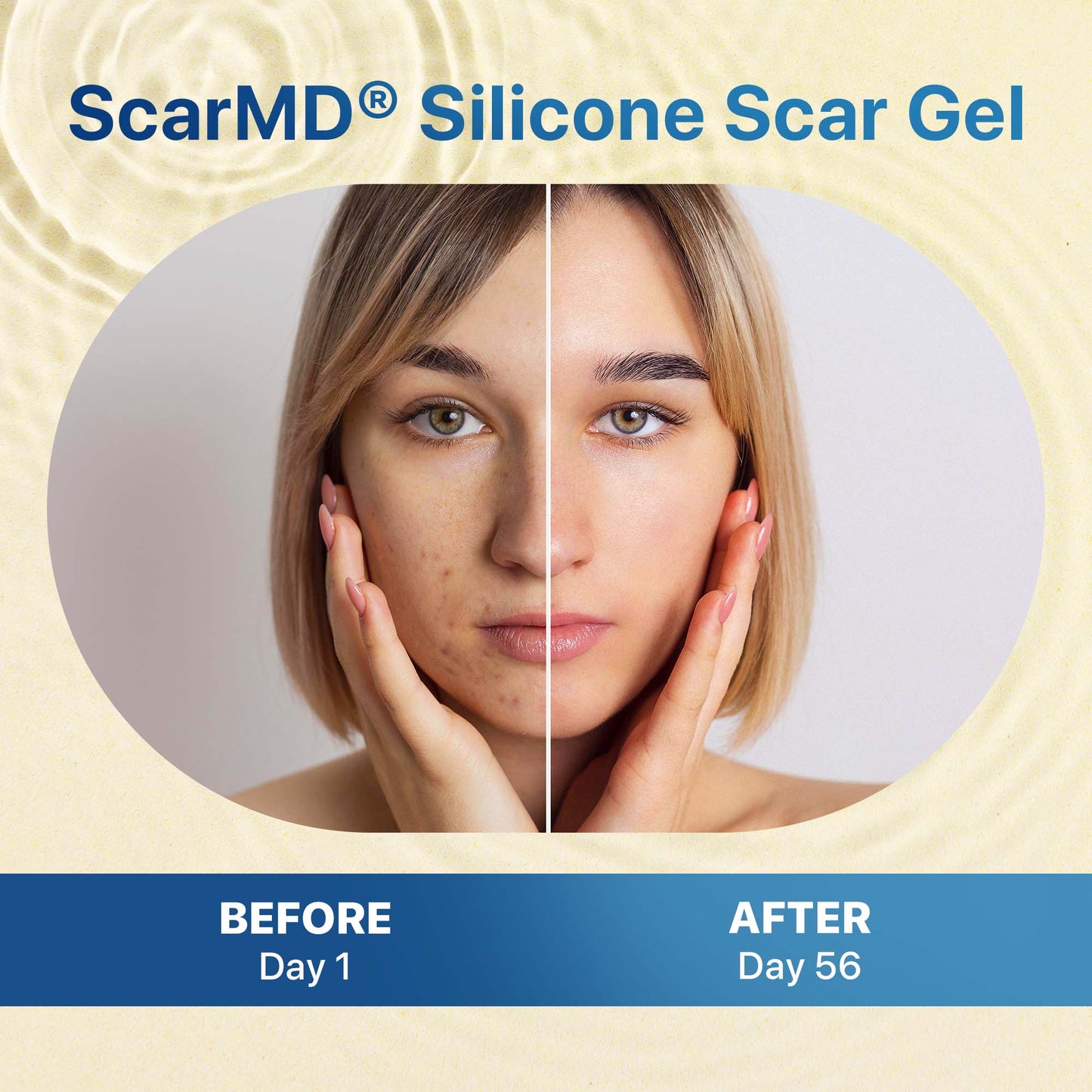 Medical Grade Silicone Scar Treatment Glide