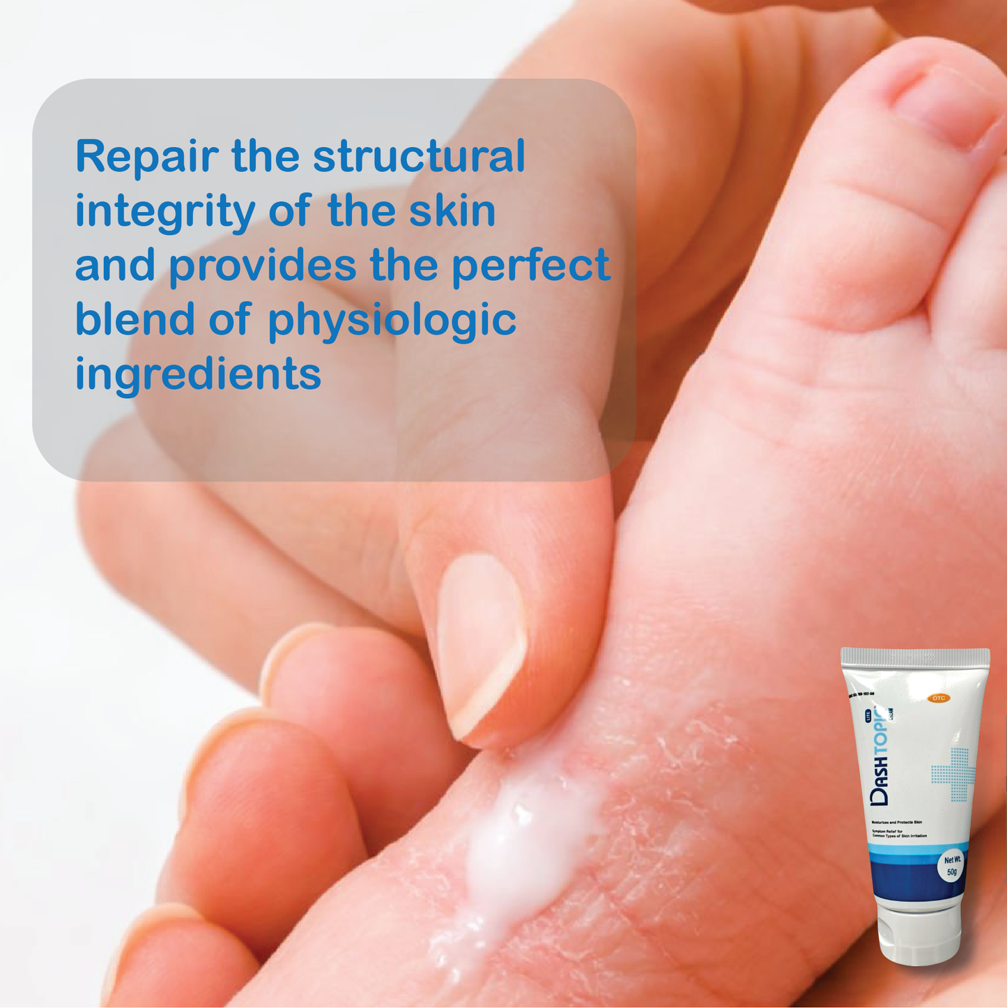 Dash Topic Lite Cream (OTC)